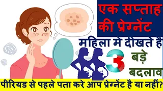 प्रेगनेंसी के शुरुवाती लक्षण | CHANGES IN SKIN | EARLY PREGNANCY SYMPTOMS