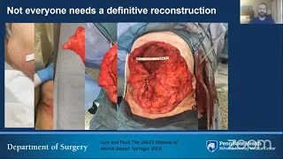 Mesh Explantation and Beyond: What Now? - Dr. Eric Pauli #LOD2021 #AWRSC
