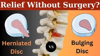 Herniated Disc vs Disc Bulge: What's the Difference & How to Heal Them?