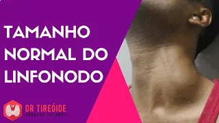 Qual é o tamanho normal do linfonodo? - Dr Jônatas Catunda de Freitas