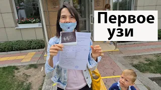 VLOG: Он все таки заставил меня сделать УЗИ / 14 недель