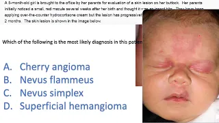 Dermatology Questions USMLE