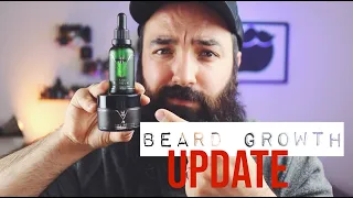 THE BEARD STRUGGLE Beard Growth UPDATE | Scam?