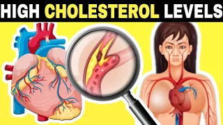 Common Signs Of High Cholesterol You Should Not Ignore