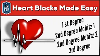 AV Heart Blocks Made Easy | 1st, 2nd, 3rd Degree [ECG Interpretation Explained]