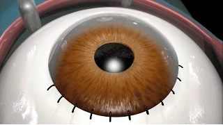 Cataract Surgery (2009)