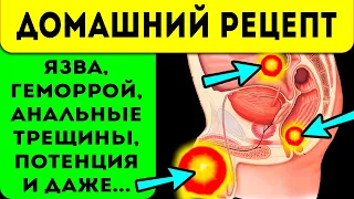 Прополис ЛЕЧИТ ВСЁ! Простатит, язва, геморрой и... Применение и свойства прополиса