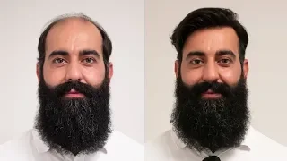 Barber Hair & Beard Look 2018 | Transformation with Haarsystem | Hairsystems Heydecke