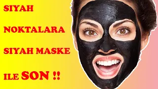 SİYAH MASKE İLE SİYAH NOKTALARA SON | Kömür Maskesi Nasıl Yapılır ? | Aktif Karbon Maskesi