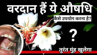 Oral Submucous Fibrosis Treatment With Ayurveda [ Osmf Treatment In Hindi ]