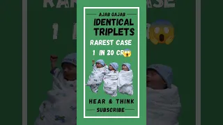 Rarest Identical triplets 😱 #shorts #pregnancy  #triplets #news #Hearandthink