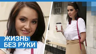 Жизнь без руки: откровенный рассказ девушки | 76.RU