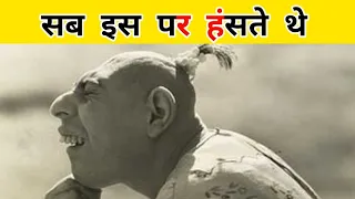 इसके माँ बाप ने इसे बेच दिया फिर उसके बाद जो हुआ उसे दुनिया याद रखेगी | Sad Story of Schlitzie