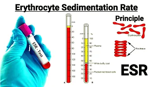 ESR test in hindi || Mechanism of ESR || Factor affecting ESR || Full information about ESR in hindi