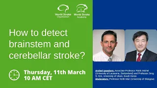 Jong S Kim: Specific brainstem and cerebellar stroke syndrome