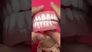 Denture After extract teeth