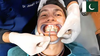 My First Time Visiting A Pakistani Dentist 🇵🇰