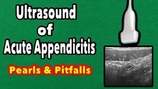 Ultrasound of Acute Appendicitis: Pearls and Pitfalls