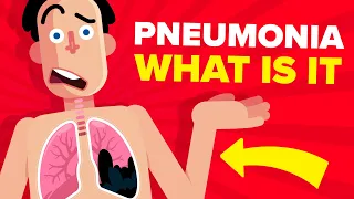 Pneumonia - Explained