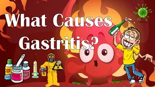 What Causes Gastritis? |Major Causes Of Gastritis