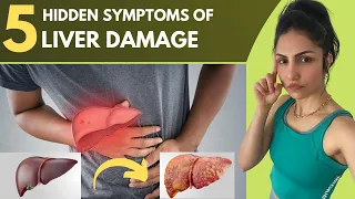 5 Hidden Symptoms of Liver Damage #shorts