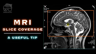 MRI – SLICE COVERAGE – A USEFUL TIP