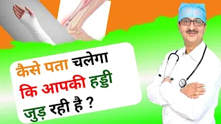 कैसे पता चलेगा कि आपकी हड्डी जुड़ रही है?