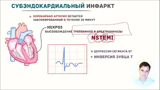 ЭКГ за 100 минут №7: Ишемия и Инфаркт на ЭКГ