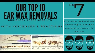 TOP 10 EAR WAX REMOVAL VIDEOS - NUMBER 7