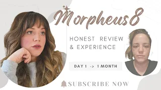 Morpheus8 BEFORE AND AFTER | SKIN CARE #review #microneedling saving in style #savinginstyle