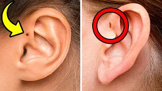 Deine Ohren verraten, wie selten du bist + 10 einzigartige Körpermerkmale