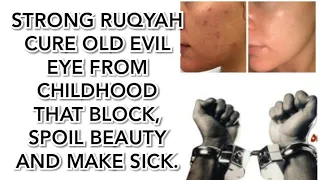 STRONG RUQYAH CURE OLD EVIL EYE FROM CHILDHOOD THAT BLOCK,SPOIL BEAUTY  AND MAKE SICK.