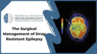 The Surgical Management of Drug Resistant Epilepsy