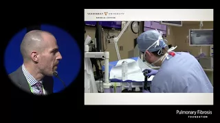 New Approaches to Diagnosis: Potential Role for Cryobiopsy | Fabien Maldonado, MD