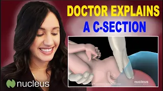 Doctor Uses 3D Animation to Explain C-Section