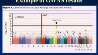 Public Health 250A   Lecture 15  Genetic Factors in Disease