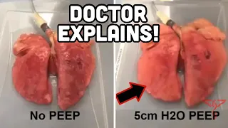 P.E.E.P. in 90 seconds - DOCTOR Explains