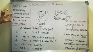 Caldwell Luc operation