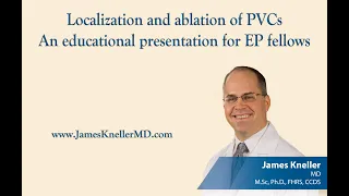 Localization and ablation of PVCs-An educational presentation for EP fellows