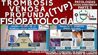 TROMBOSIS VENOSA PROFUNDA FISIOPATOLOGÍA | GuiaMed