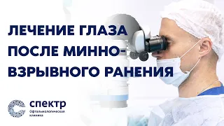 Хирургическое лечение жителя Украины после минно-взрывного ранения глаза.