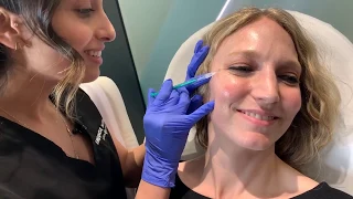 Botox for Women | Movement Lines Treatment | West Hollywood, CA | Dr. Jason Emer