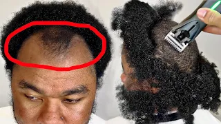 this guy paid me $80 to FIX his hairline... (TRANSFORMATION)