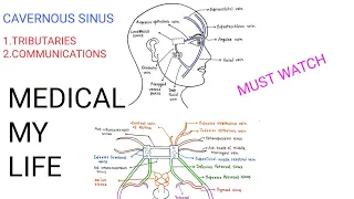 CAVERNOUS SINUS , PART-2