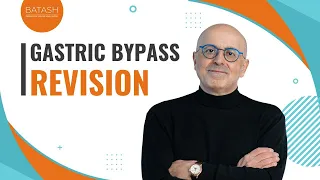 Endoscopic Revision Of Gastric Bypass Explained