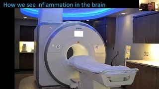 Dr. Jarred Younger Presents: How We Can See ME/CFS Inflammation In the Brain
