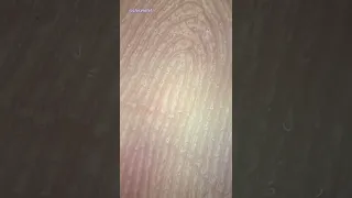 Sweaty Fingers Under Microscope