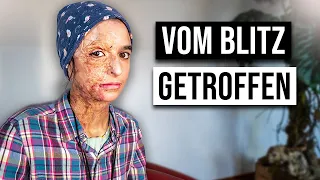 Wie ist das VOM BLITZ GETROFFEN ZU WERDEN?