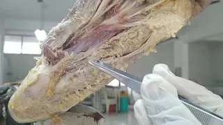 1st and 2nd layer muscles of sole of foot.