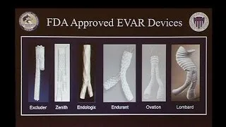 New and Emerging Devices to Treat Abdominal Aortic Aneurysms